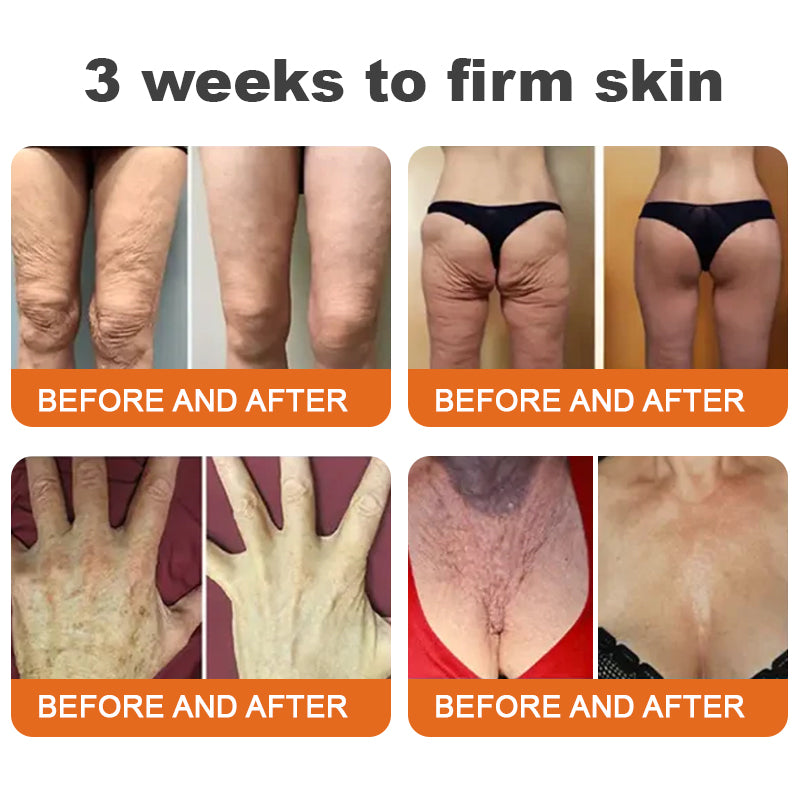 🔥🐝(PROMO 2x1 ) Flysmus™ Suero reafirmante con veneno de abeja y botox🐝🔥 Dankat