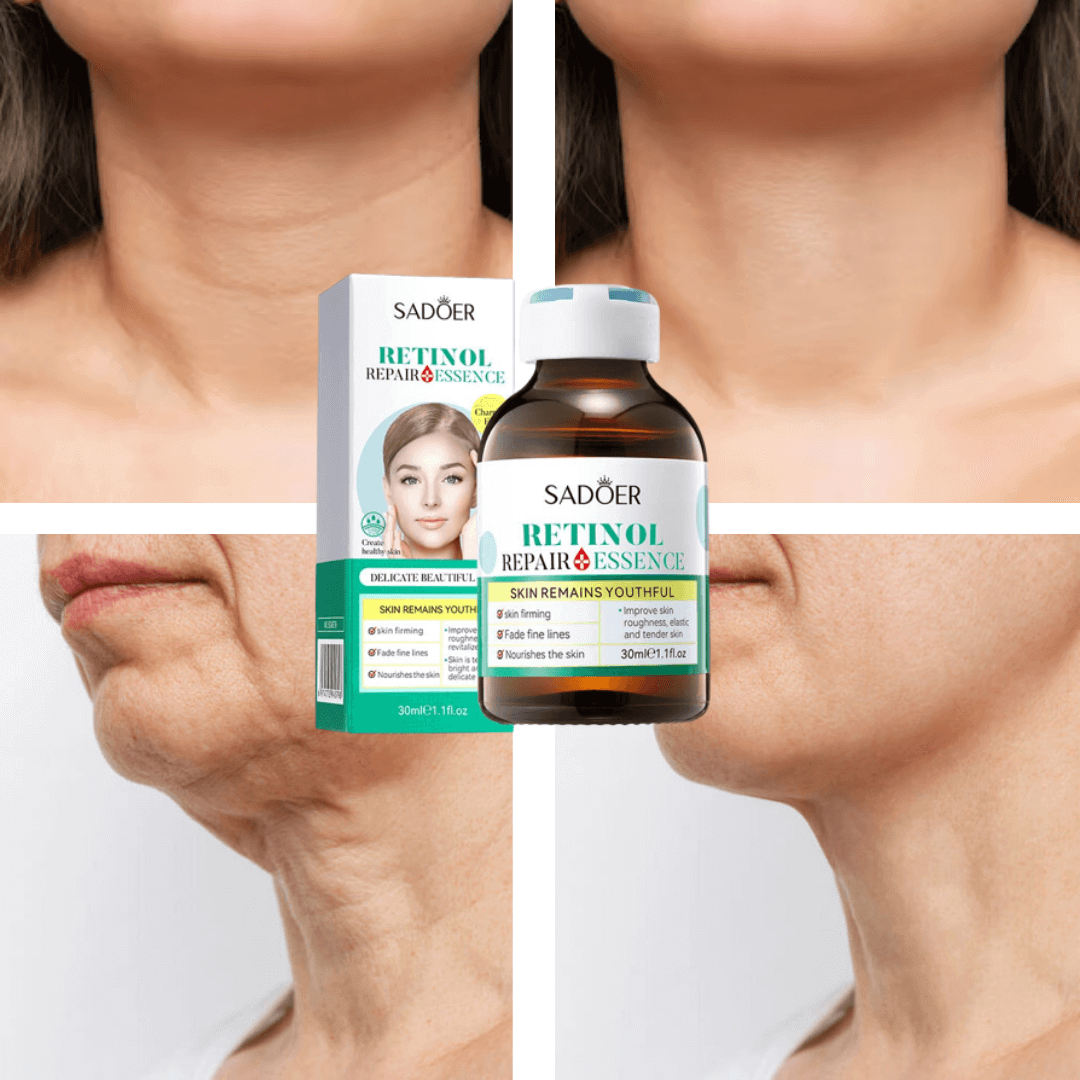 SUERO FACIAL DE RETINOL ELIMINADOR DE ARRUGAS ORIGINAL® Noah Tienda