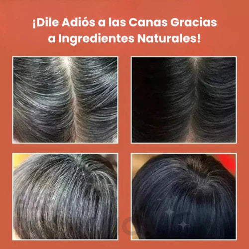 Combo Chau Canas y Chau Frizz🎁 Paga en tu puerta YA Colombia