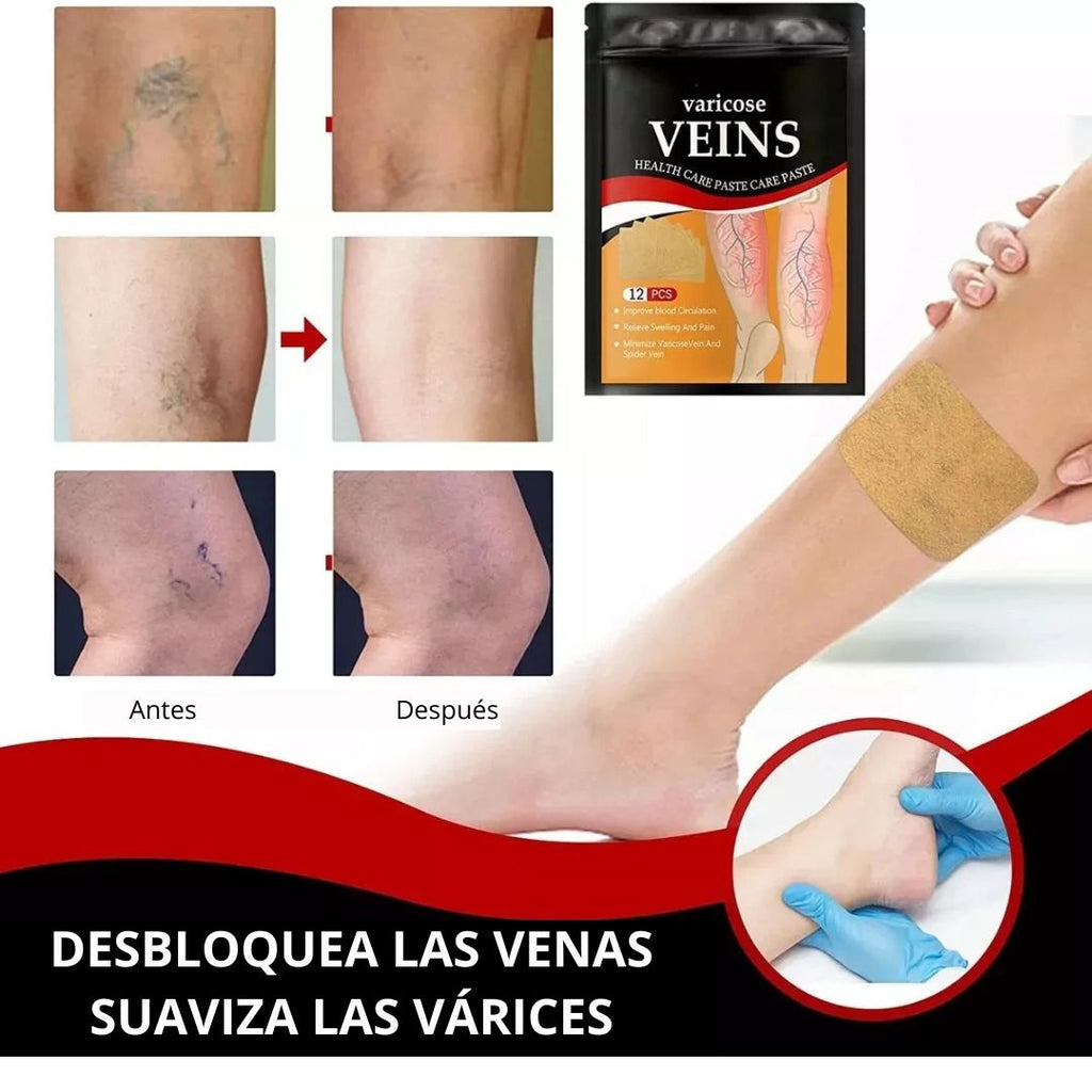 Parche varicose Veins para vena varice La Yupi!