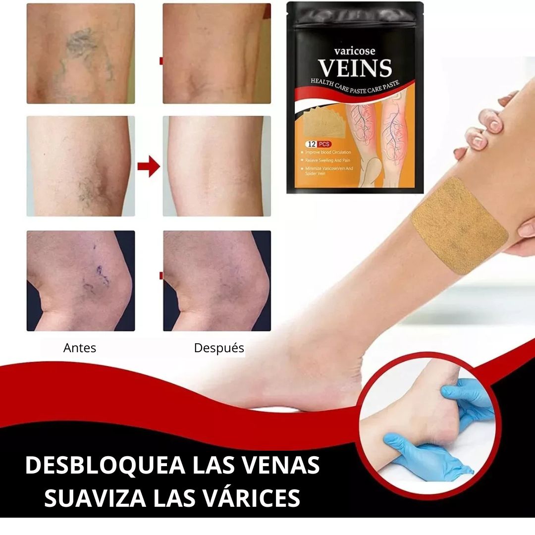 Parche varicose Veins para vena varice La Yupi!