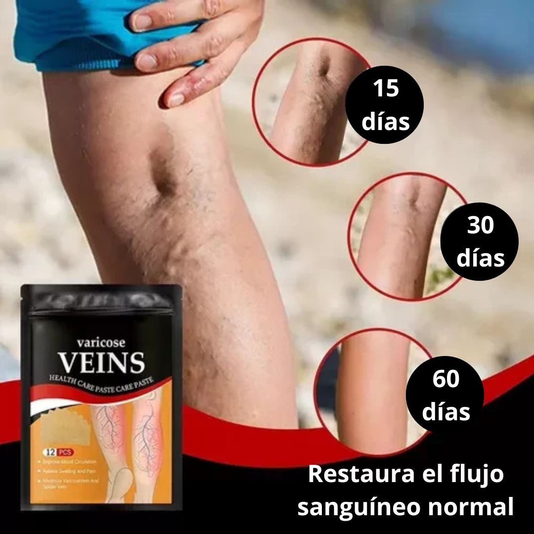 Parche varicose Veins para vena varice La Yupi!