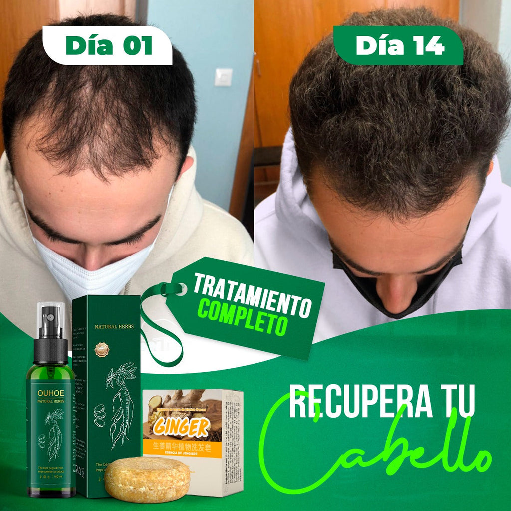 OUHOE Spray Crece Pelo La Yupi!