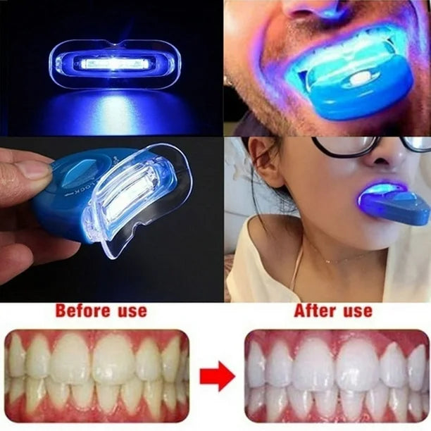 KIT BLANQUEADOR DE DIENTES 20 MIN Minha loja