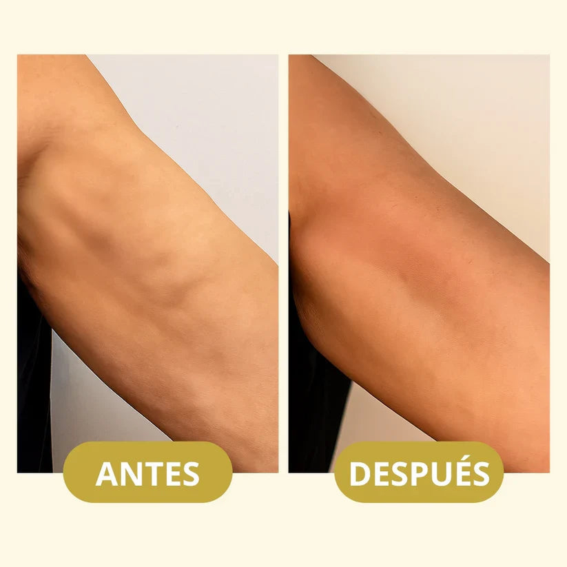 MagicFirm™ Aceite Corporal de Lujo | Reafirma la piel un 90% en 4 semanas - 100% GARANTIZADO Noah Tienda