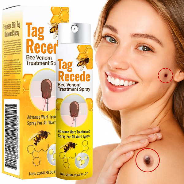 MEGA PROMOCION! 2x1!  Eliminador de Verrugas-Tag Recede® La Yupi!