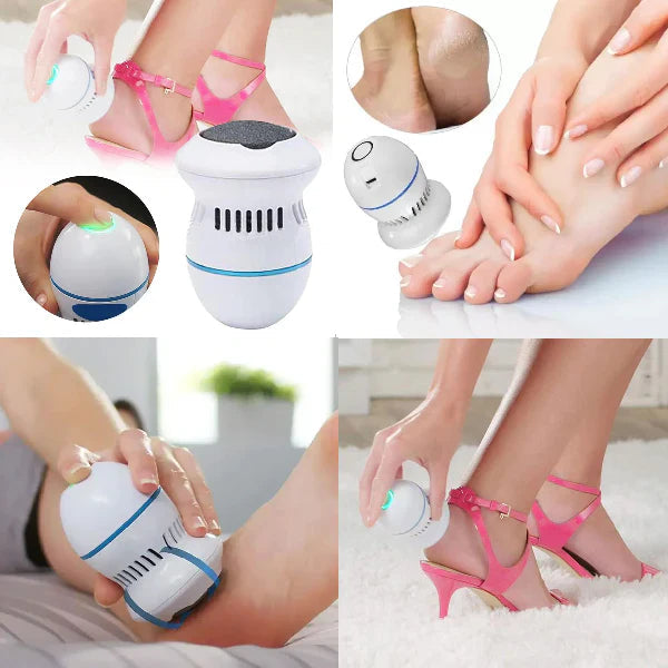 SuaviFeet® Quita Callos Electrico Dankat