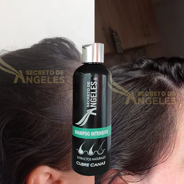 KIT 3x1 - SHAMPO CANAS SECRETOX 1UN+2OBSEQ La Yupi!