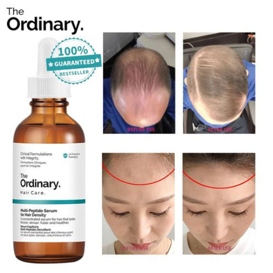 Suero Capilar Anti‑Caída The Ordinary - Multi‑Péptidos + Resultados en 15 días La Yupi!