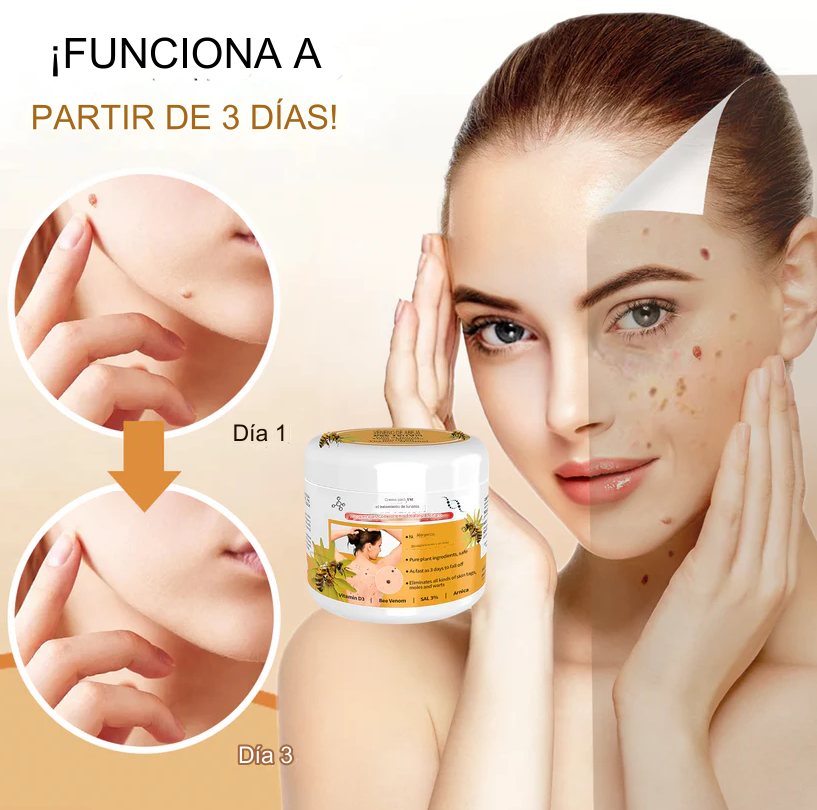 PROMO 2X1 🔥🐝 Crema para el tratamiento de lunares y verrugas con veneno de abeja Lenaro Dankat