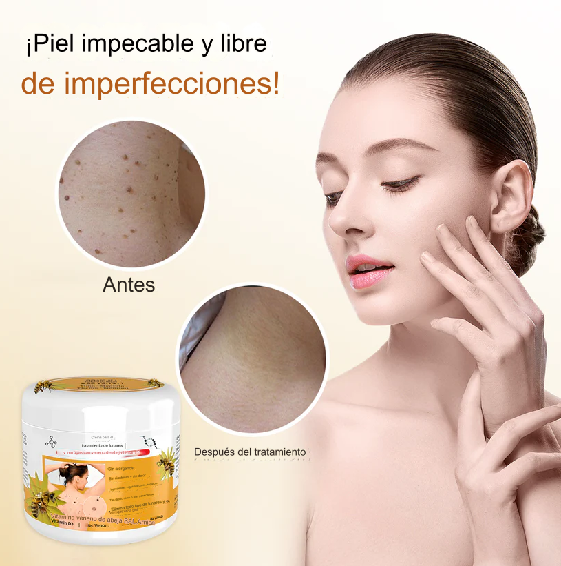 PROMO 2X1 🔥🐝 Crema para el tratamiento de lunares y verrugas con veneno de abeja Lenaro Dankat