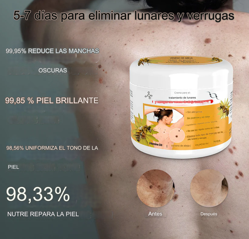 PROMO 2X1 🔥🐝 Crema para el tratamiento de lunares y verrugas con veneno de abeja Lenaro Dankat