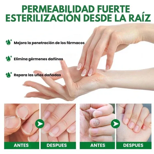 FUNGUSFREE - ANTI HONGO TOENAILPLUS - Compra 1 y llévate 2! Tienda Colombia