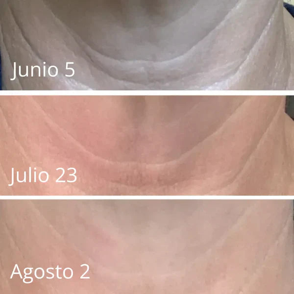 LuxeLift - Crema Reafirmante Y Rejuvenecedora De Piel Dankat