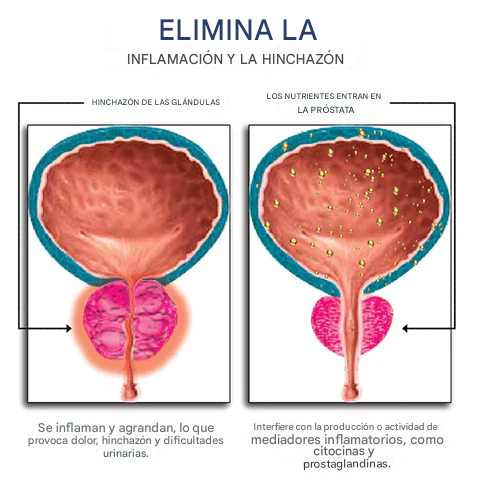 Oveallgo™ ProstaFlow - Alivio rápido de la Prostata Dankat