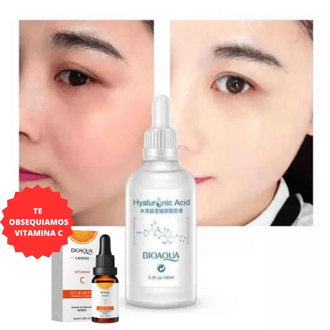 TÓNICO DESPIGMENTANTE ÁCIDO HIALURÓNICO BIOAQUA ORIGINAL® | RECIBE OBSEQUIO Noah Tienda