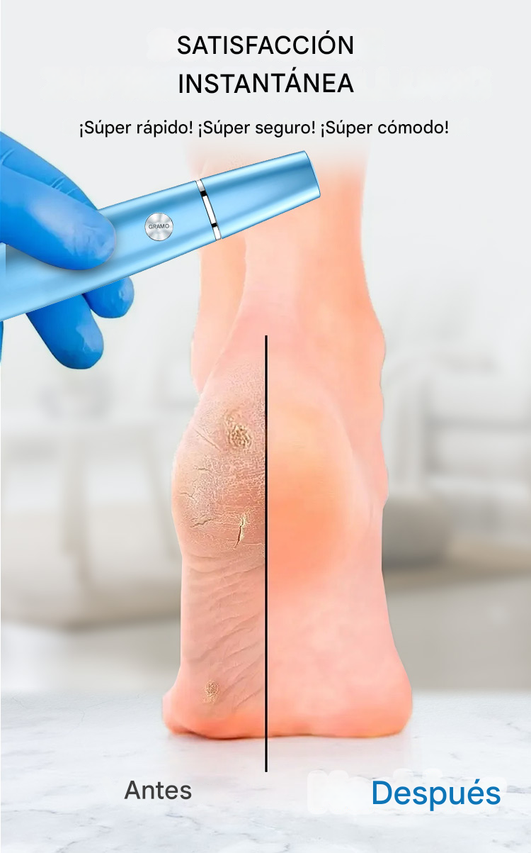 SilkyStep™ – Removedor Eléctrico de Callos Profesional Dankat