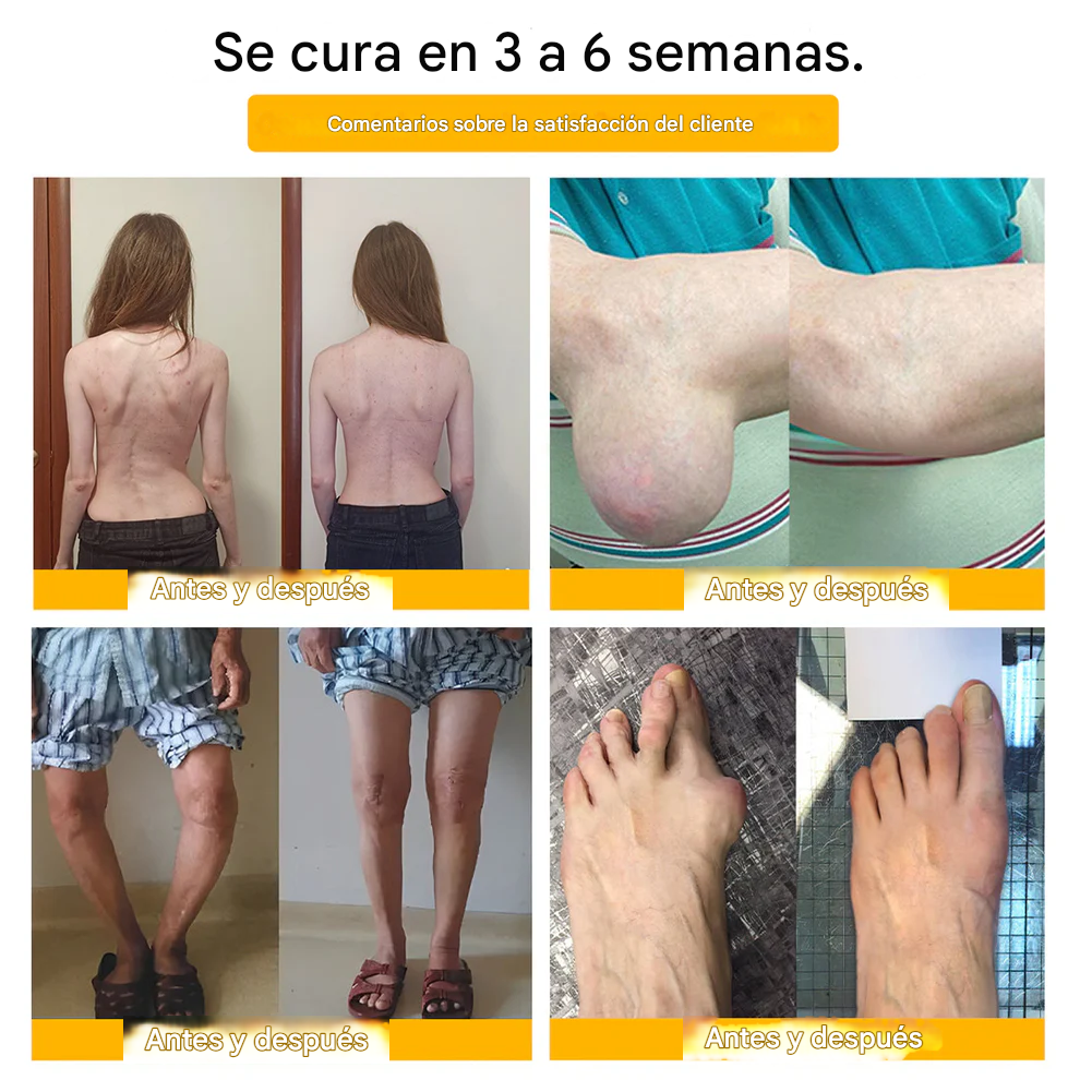 PROMO 2x1 - Crema Para La Curación De Huesos Y El Alivio Del Dolor Con Bótox Dankat