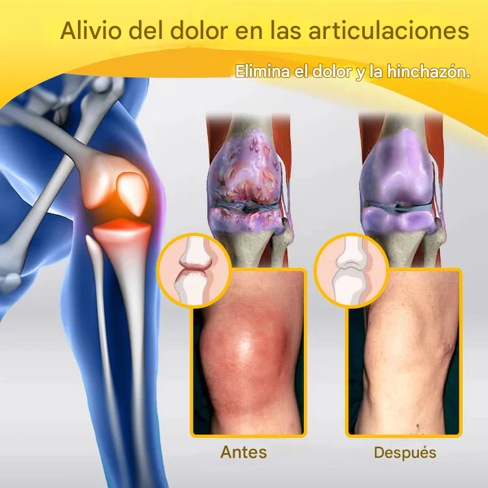 PROMO 2x1 - Crema Para La Curación De Huesos Y El Alivio Del Dolor Con Bótox Dankat