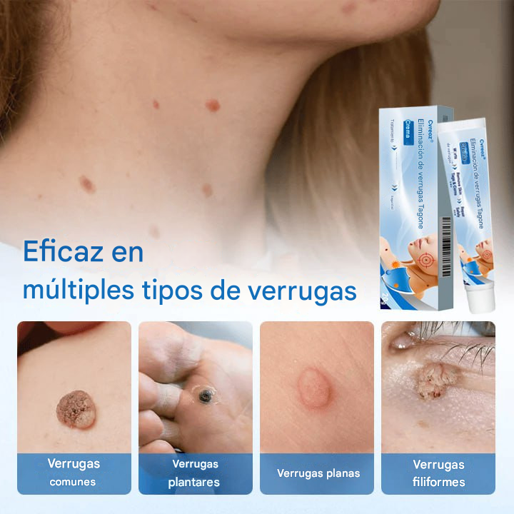 Crema para eliminar verrugas Cvreoz® TagGone Dankat