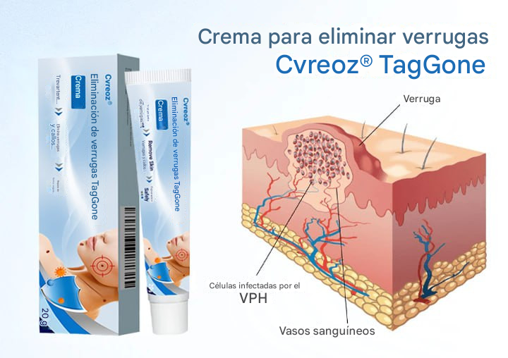 Crema para eliminar verrugas Cvreoz® TagGone Dankat