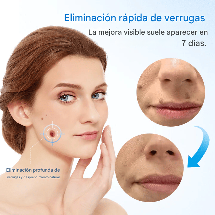 Crema para eliminar verrugas Cvreoz® TagGone Dankat