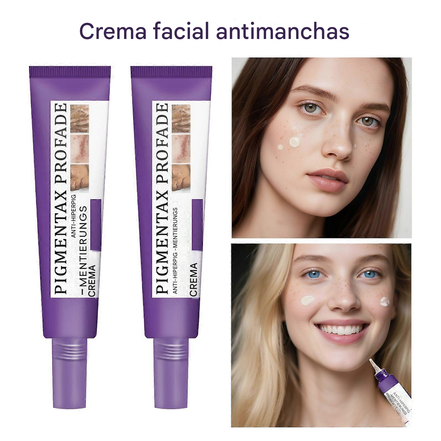 Crema Epiglow Melanex Advanced Anti-hiperpigmentación Dankat