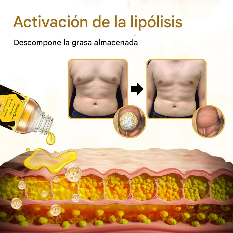 🔥PROMO 2X1 🔥Aceite Para Ginecomastia Con Veneno De Abeja Biancat® ThermoFirm Dankat