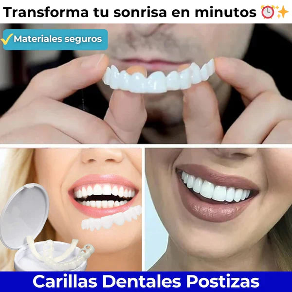 Carillas Dentales Monturas - ¡Sonrisa Perfecta al Instante! Noah Tienda